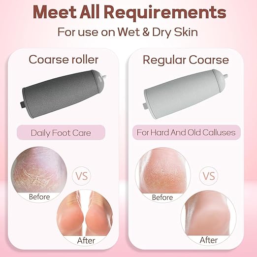Electric Foot Callus Remover (Feet Dead Skin Remover)