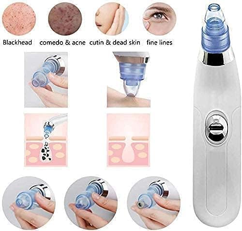 Derma Suction Electric Facial Pore Cleanser – Vacuum Blackhead Remover & Acne Suction Tool with 4 Interchangeable Heads